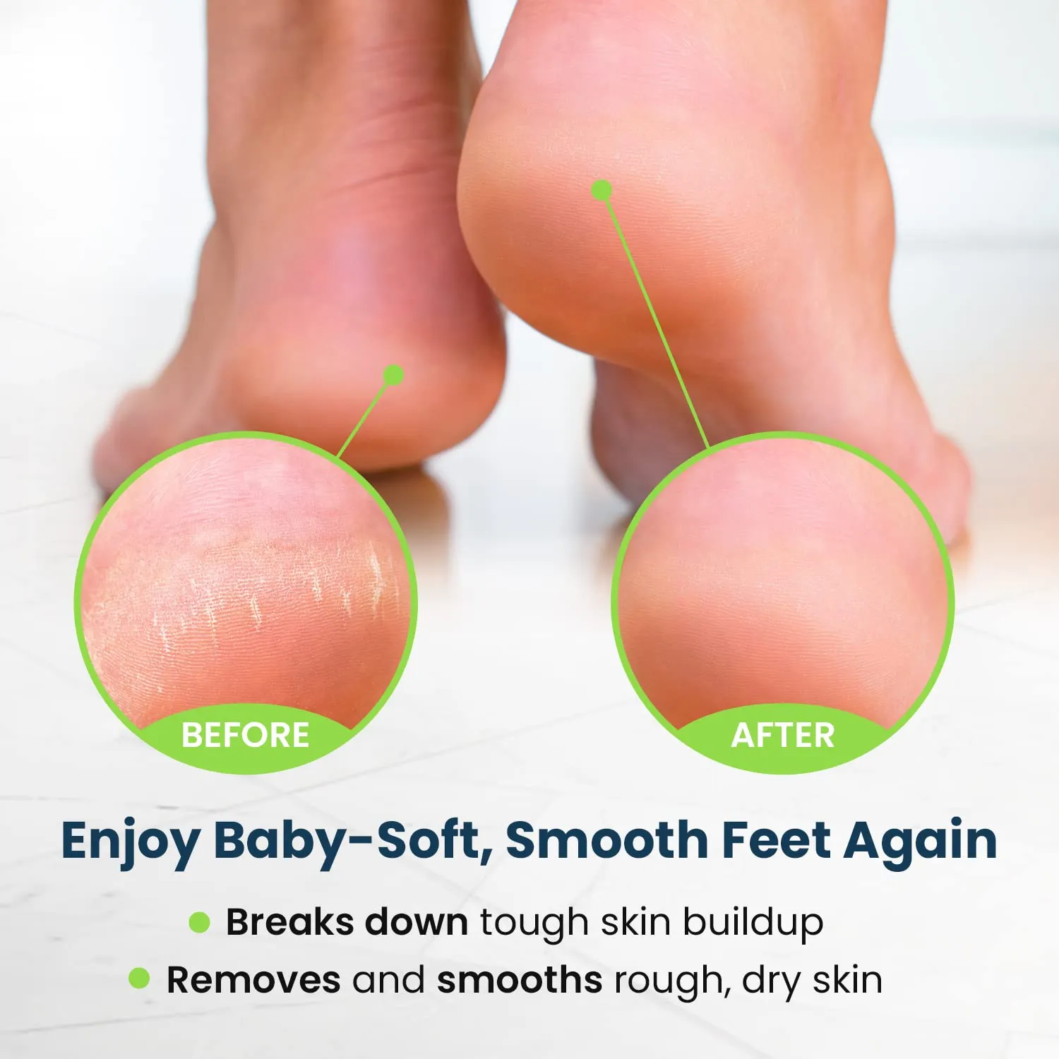 Toenail Fungus Treatment Extra Strength - Advance nail fungus treatment for fingernails, nail repair, toenail softener, yellow toenail treatment, ingrown nail and foot fungus treatment extra strength