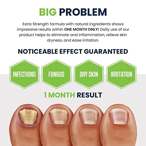 Toenail Fungus Treatment Extra Strength - Advance nail fungus treatment for fingernails, nail repair, toenail softener, yellow toenail treatment, ingrown nail and foot fungus treatment extra strength